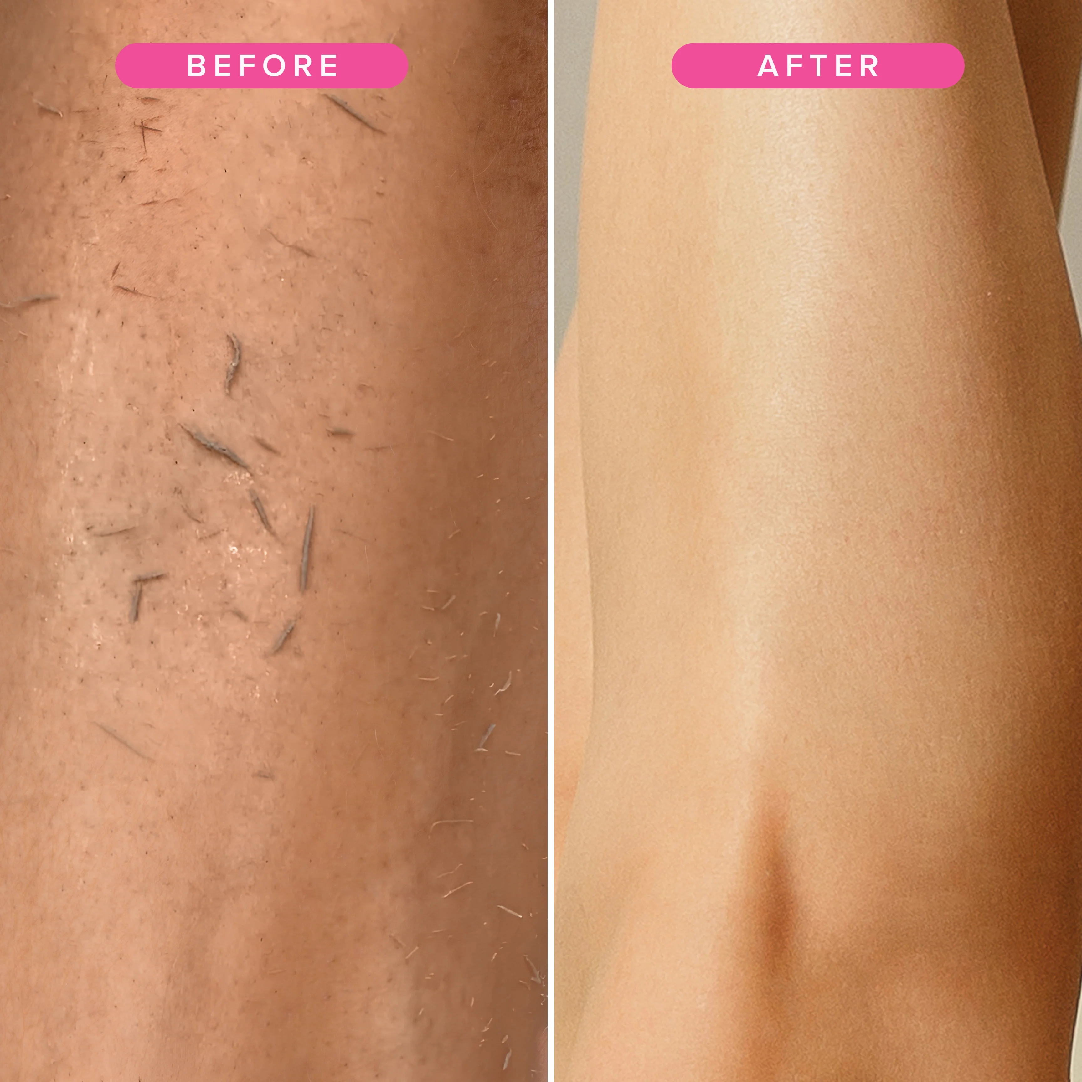 NYK1 Exfolimitt Spa Mitt (Black / Pink) - Image 17